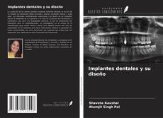 Couverture de Implantes dentales y su diseño