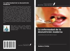Capa do livro de La enfermedad de la desnutrición moderna 