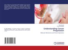 Borítókép a  Understanding Cancer Progression - hoz