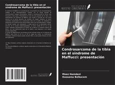 Bookcover of Condrosarcoma de la tibia en el síndrome de Maffucci: presentación