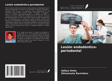 Couverture de Lesión endodóntico-periodontal