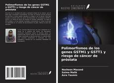Bookcover of Polimorfismos de los genes GSTM1 y GSTT1 y riesgo de cáncer de próstata