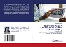 Обложка Beyond the Image: A Comprehensive Guide to Implant Imaging