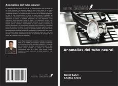 Couverture de Anomalías del tubo neural