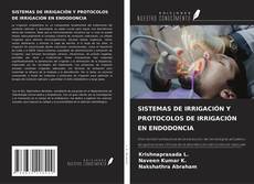 SISTEMAS DE IRRIGACIÓN Y PROTOCOLOS DE IRRIGACIÓN EN ENDODONCIA的封面