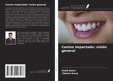 Couverture de Canino impactado: visión general