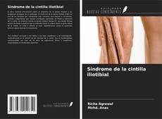 Síndrome de la cintilla iliotibial kitap kapağı