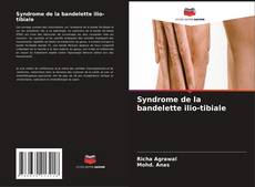 Couverture de Syndrome de la bandelette ilio-tibiale