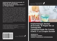 Implantología Dental Avanzada: El Papel De La Tomografía Computarizada De Conejo (Cbct) Y La Cirugía Guiada的封面