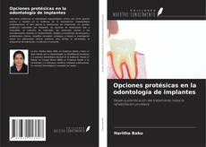 Обложка Opciones protésicas en la odontología de implantes