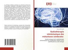Buchcover von Radiothérapie stéréotaxique des métastases cérébrales