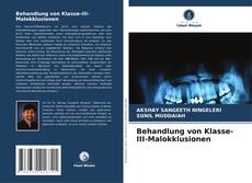 Buchcover von Behandlung von Klasse-III-Malokklusionen