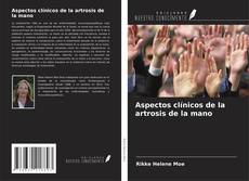 Couverture de Aspectos clínicos de la artrosis de la mano