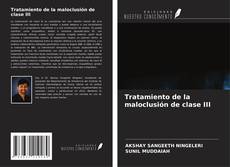 Tratamiento de la maloclusión de clase III的封面