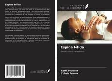 Couverture de Espina bífida