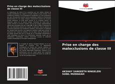 Обложка Prise en charge des malocclusions de classe III