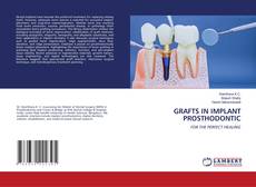 Bookcover of GRAFTS IN IMPLANT PROSTHODONTIC