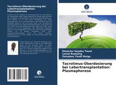 Couverture de Tacrolimus-Überdosierung bei Lebertransplantation: Plasmapherese