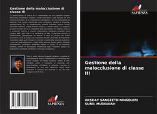 Couverture de Gestione della malocclusione di classe III