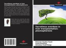 Tacrolimus overdose in liver transplantation: plasmapheresis的封面