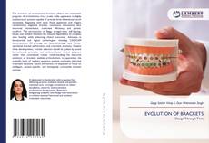 Bookcover of EVOLUTION OF BRACKETS