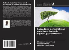Couverture de Sobredosis de tacrolimus en el trasplante de hígado: plasmaféresis