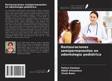 Buchcover von Restauraciones semipermanentes en odontología pediátrica
