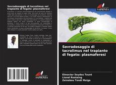 Couverture de Sovradosaggio di tacrolimus nel trapianto di fegato: plasmaferesi