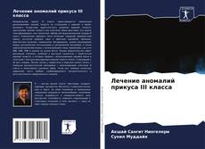 Лечение аномалий прикуса III класса kitap kapağı