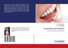 Laminates and Veneers的封面
