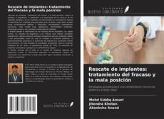 Copertina di Rescate de implantes: tratamiento del fracaso y la mala posición