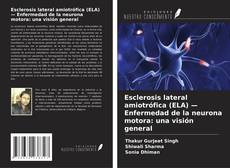 Buchcover von Esclerosis lateral amiotrófica (ELA) — Enfermedad de la neurona motora: una visión general