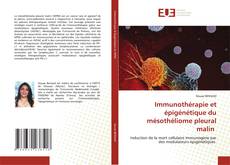 Couverture de Immunothérapie et épigénétique du mésothéliome pleural malin