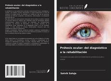 Copertina di Prótesis ocular: del diagnóstico a la rehabilitación
