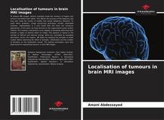 Bookcover of Localisation of tumours in brain MRI images