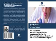 Copertina di Allergische Kontaktdermatitis, verursacht durch Zahnimplantatschrauben und Zahnbehandlungen