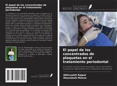 Copertina di El papel de los concentrados de plaquetas en el tratamiento periodontal