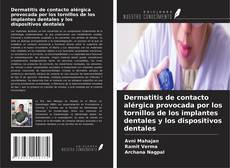 Portada del libro de Dermatitis de contacto alérgica provocada por los tornillos de los implantes dentales y los dispositivos dentales