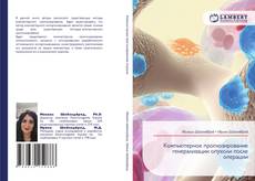 Bookcover of Компьютерное прогнозирование генерализации опухоли после операции