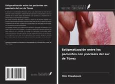 Couverture de Estigmatización entre los pacientes con psoriasis del sur de Túnez