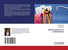 Buchcover von Apical patency in endodontics