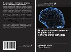 Bookcover of Brechas osteomeníngeas: el papel de la cisternografía isotópica