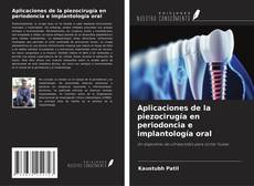 Aplicaciones de la piezocirugía en periodoncia e implantología oral kitap kapağı
