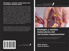 Buchcover von Etiología y señales moleculares del carcinoma hepatocelular