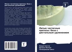 Borítókép a  Литые частичные протезы: база с дистальным удлинением - hoz