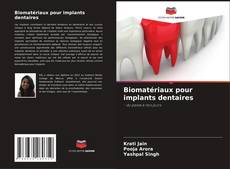 Buchcover von Biomatériaux pour implants dentaires