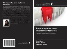Portada del libro de Biomateriales para implantes dentales