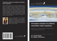 Copertina di Conceptos actuales en prótesis removibles sobre implantes