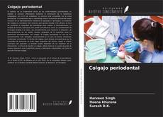 Couverture de Colgajo periodontal