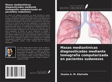 Capa do livro de Masas mediastínicas diagnosticadas mediante tomografía computarizada en pacientes sudaneses 